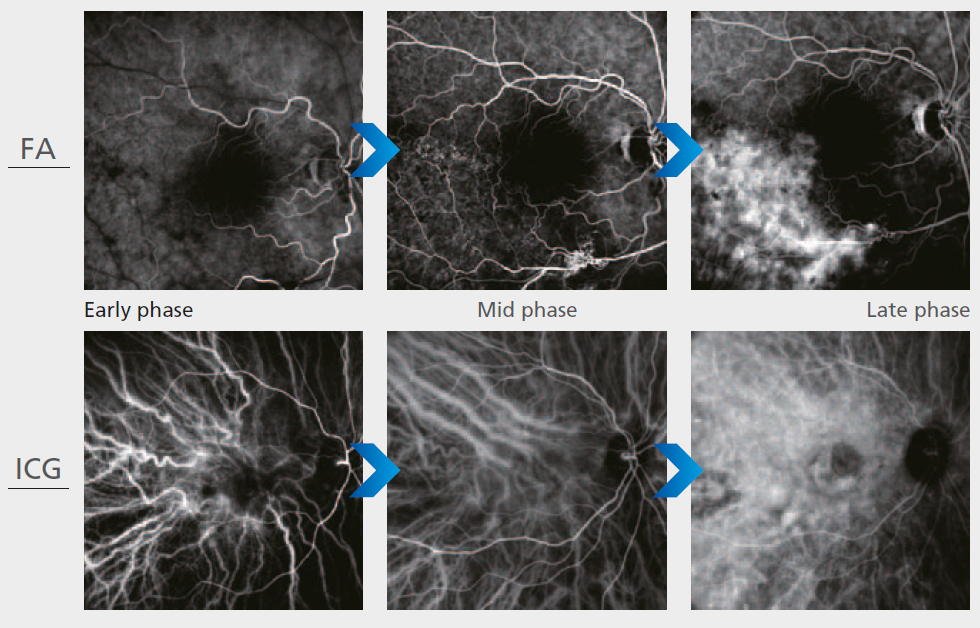 HD dynamic and static angiogram