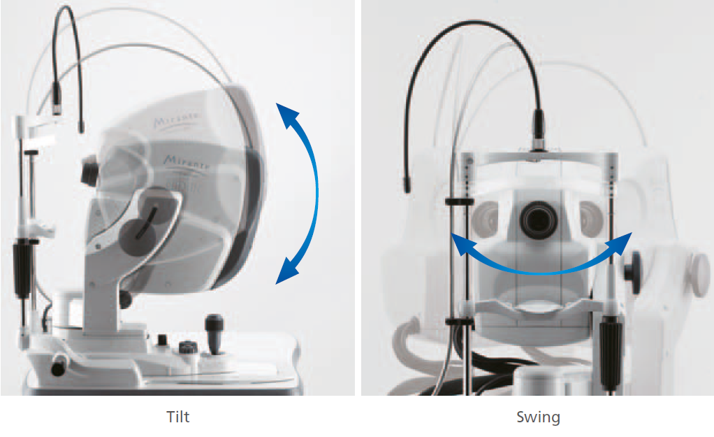 NIDEK Mirante Swing & Tilt Features